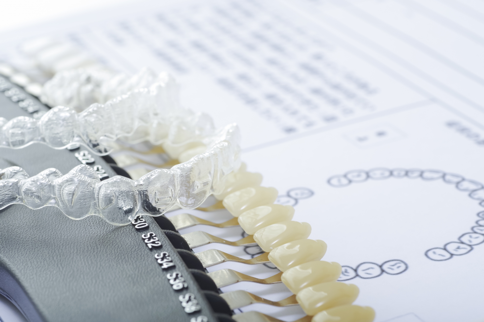 治療前を受ける前に知っておきたい！審美歯科のメリット・デメリットとは？